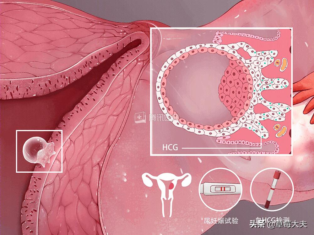 医生也成“催生婆”？不！是你输卵管出问题了......