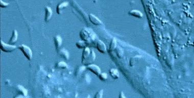 全世界有多少人被弓形虫感染,弓形虫感染率占全球多少