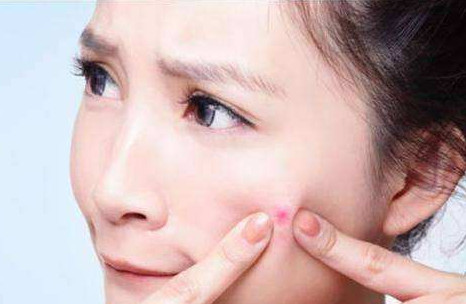 祛痘印缩毛孔的护肤精油,祛痘淡化痘印控油收缩毛孔精油