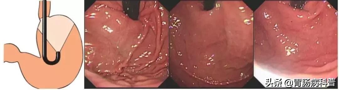 医生做胃镜检查时会看食道的吗,胃镜检查全过程视频消化内科检查