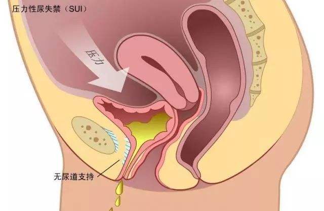 这病女性难以启齿,中老年难堪!中德专家聚首沈阳四院,破解难题