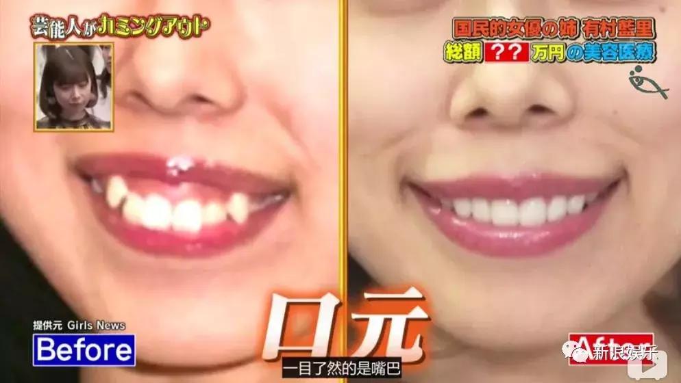 那些整容脸真的觉得自己好看吗,为什么整容以后都是一样的网红脸