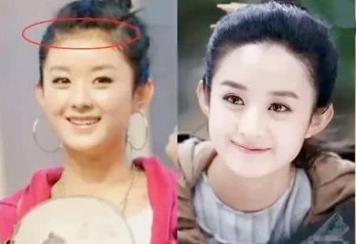 额头窄梳什么样的发型好看,额头扁平低矮