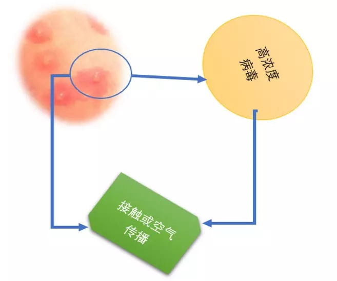 什么抗病毒药对带状疱疹效果最佳,带状疱疹抗病毒治疗优势