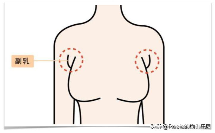 女生怎么练改善斜方肌,斜方肌练大了