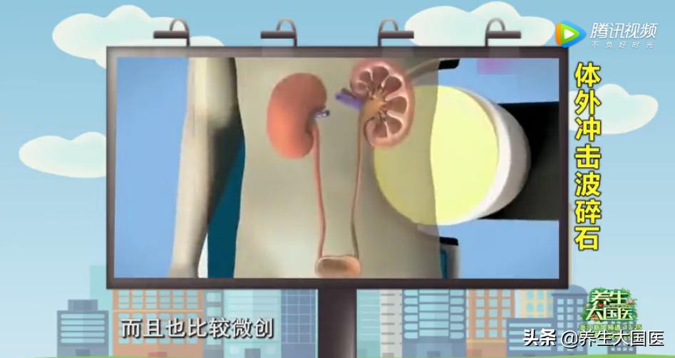 身体里长“石头”怎么办？三种治疗方式，助你恢复健康