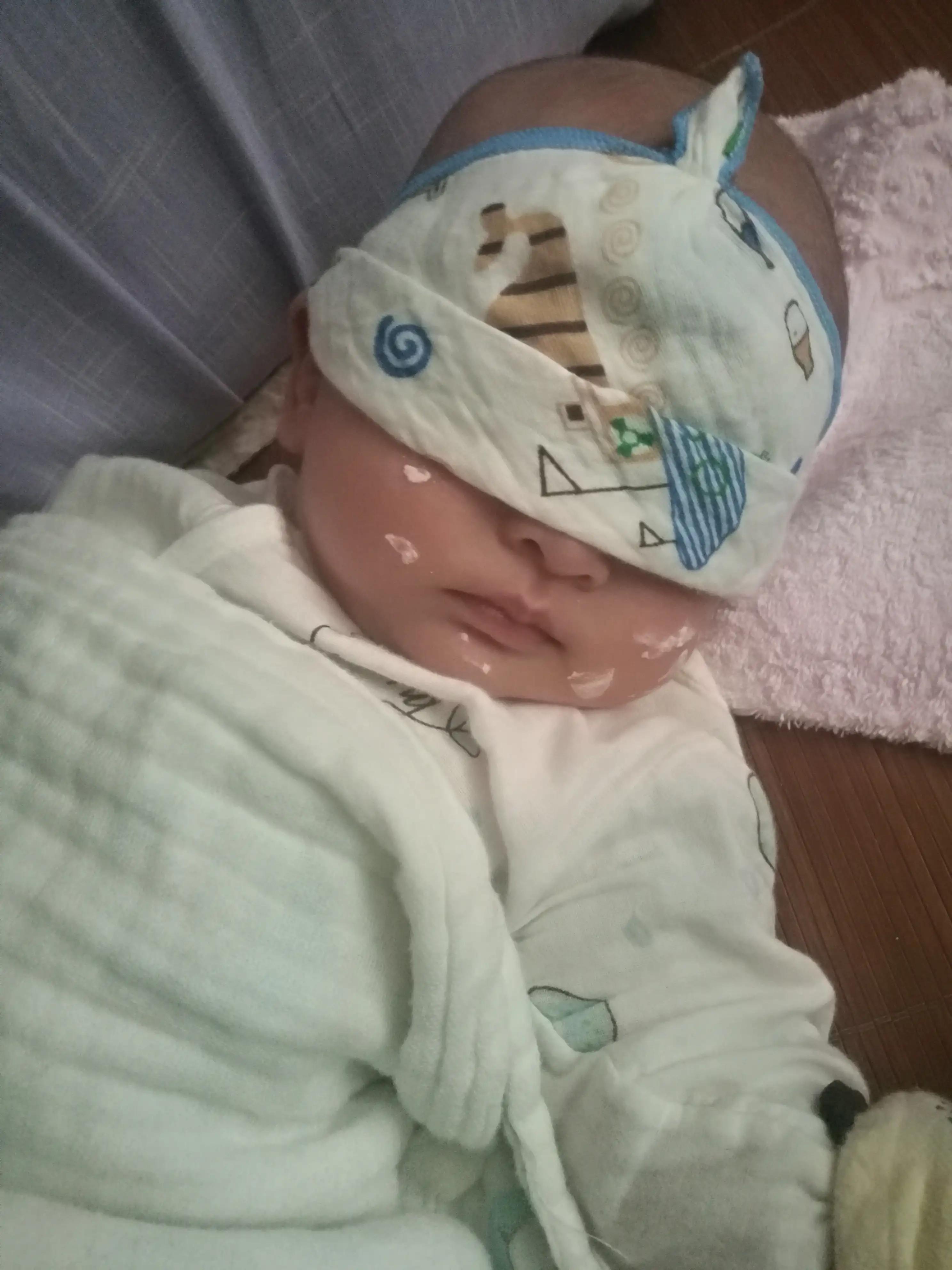 宝宝从出生要经历黄疸胀气,宝宝为什么会黄疸和湿疹