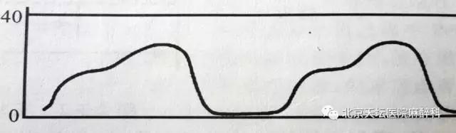 常见呼吸类型有哪几种,呼吸少量二氧化碳有什么症状