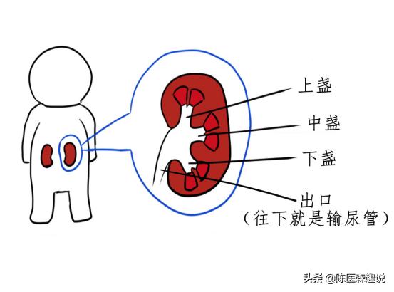 发现肾结石怎样治疗更好,发现肾结石怎么办