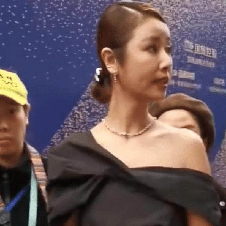 林心如一笑满脸坑坑洼洼，皮肤不如路人好，44岁真实的衰老状态