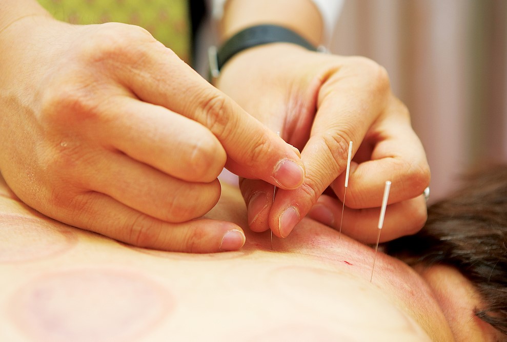 钟利群主任谈：中医治疗梅尼埃病效果明显