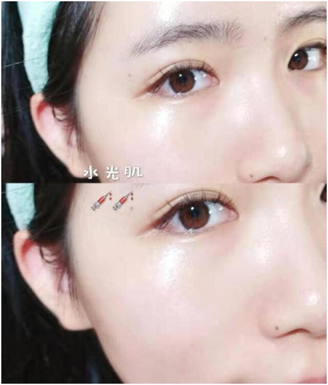 干干的发质怎么改善,干得起皮了怎么办