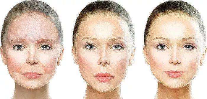 人中长怎么微调整容,人中两边宽怎么整容