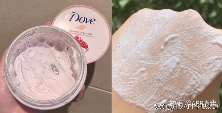 去鸡皮肤真实有效的方法,鸡皮肤如何彻底治愈