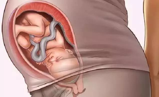 孕妇孕晚期入盆是什么感觉,孕35周已经入盆了会提前生了吗