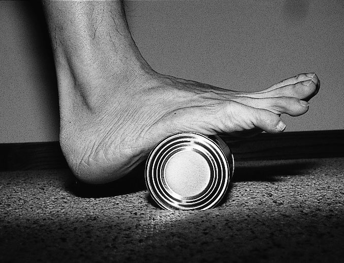 早起脚跟痛脚底板痛肿胀怎么回事,早起脚底板疼走一会又不疼了