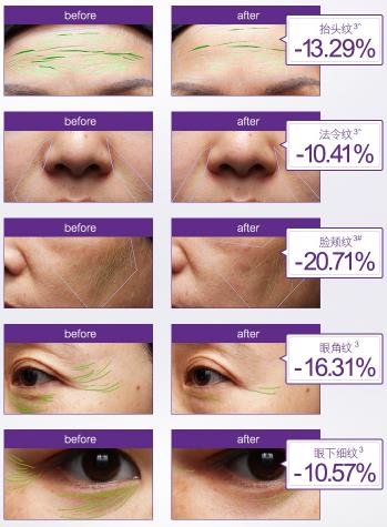 olay抗糖小白瓶和a醇,olay爆款