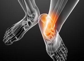 治疗痛风不止有药，干细胞让你远离痛痛痛