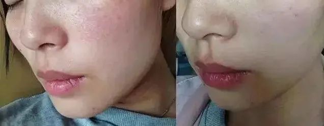 死海泥洗面膜怎么样,死海泥面膜的神奇功效是什么