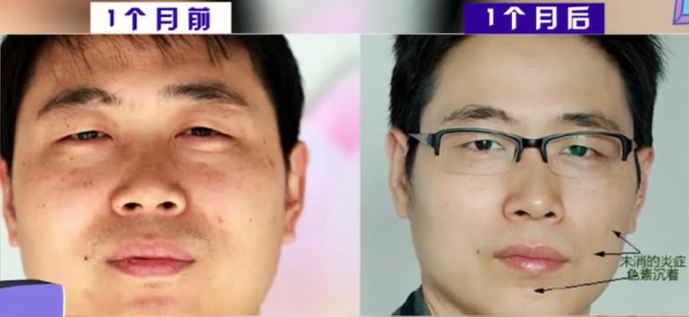 30分钟去黄提亮，变身白美人！皮肤学博士为它强力打call