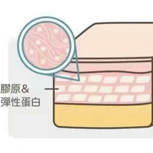 颈纹怎么消除显老,用什么方法去颈纹30年的颈纹最好