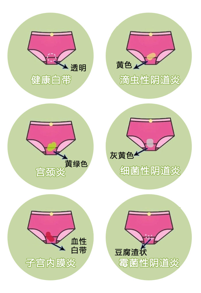 怎样区分妇科炎症,妇科双合诊怎么判断有妇科炎症