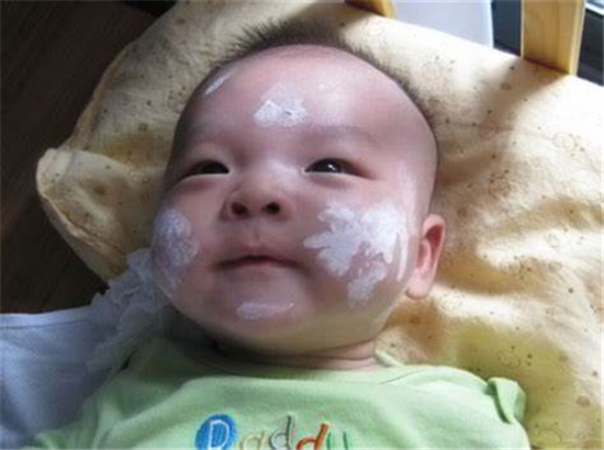 湿疹怎么治好得快婴儿湿疹,湿疹反反复复如何护理