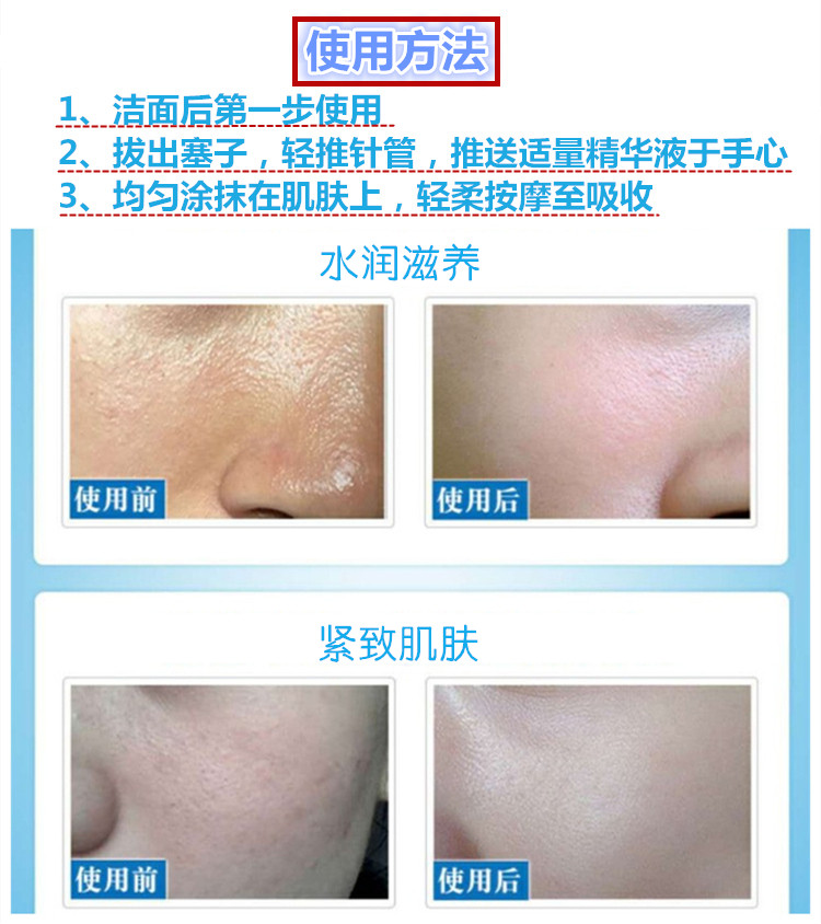 40岁女人打玻尿酸有效果吗,额头有皱纹打玻尿酸有没有后遗症