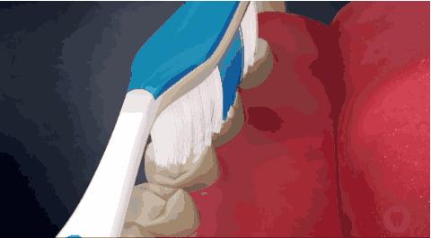 解决牙齿牙龈出血的小妙招,牙齿牙龈出血有什么好办法