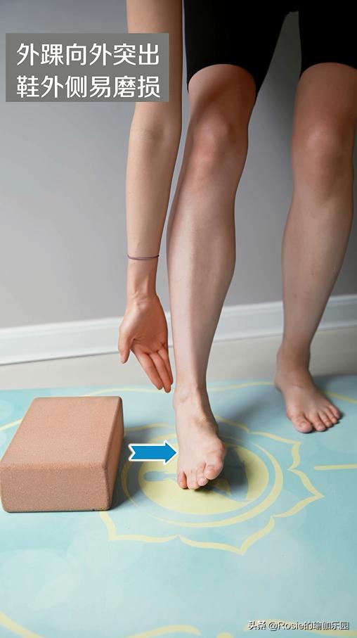 脚踝受限跛脚如何纠正,脚受伤后怎么锻炼脚踝的灵活性