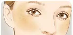 皮肤长斑有民间小方法祛斑吗,教你几招简单祛斑小方法