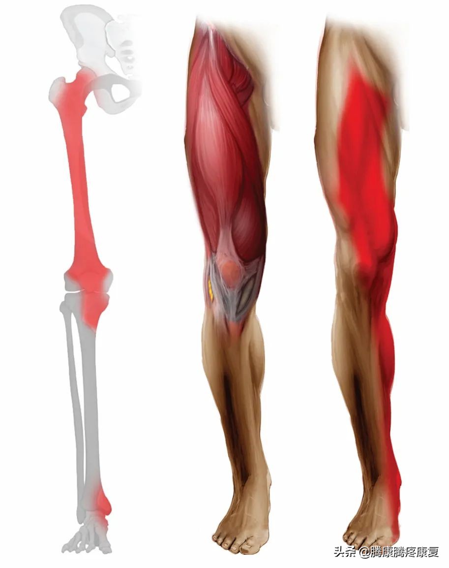 下肢常见神经损伤后表现