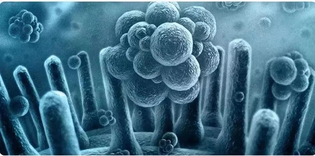 外阴瘙痒疑是真菌感染,外阴单纯瘙痒可能是外阴癌吗