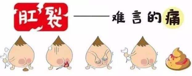肛裂肛门疼痛应该怎么治疗,肛裂是肛门疾病吗怎么治疗
