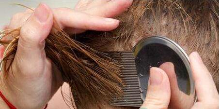 头上有虱子卵的虱子怎么彻底清除,头上长虱子怎么彻底去除更方便