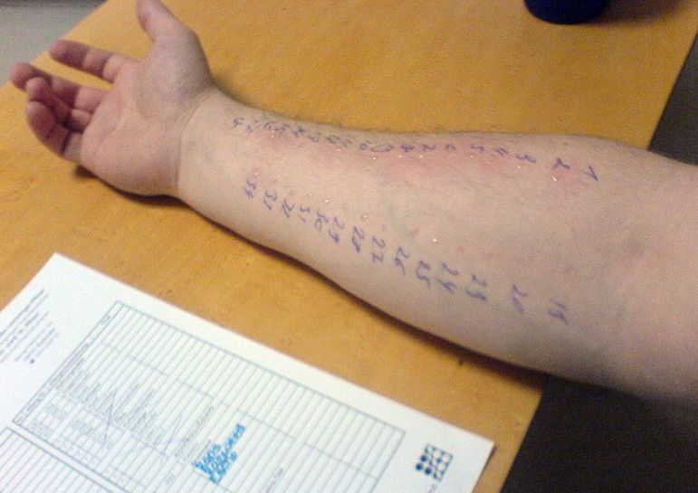 宝宝过敏好了多久可以打疫苗,宝宝过敏快好了可以打疫苗吗