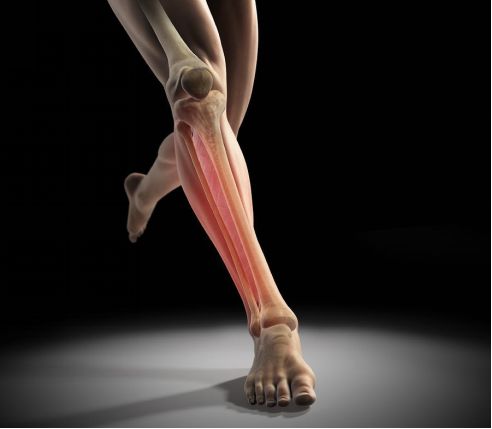 跑者小腿内侧痛,大神级跑者小腿