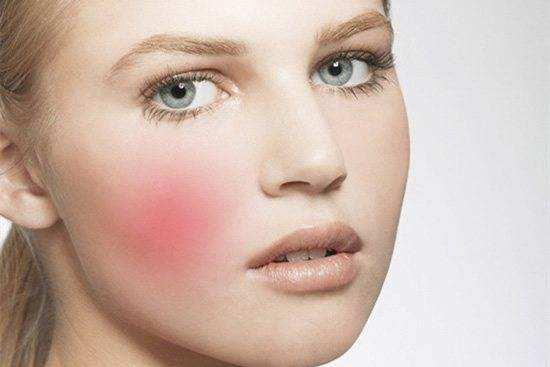 拯救面部红血丝,拯救红血丝的护肤品