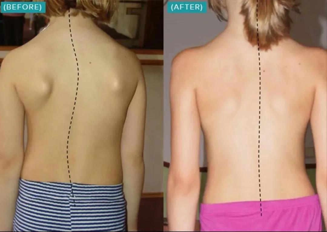 sps鍒涘浜虹悊鏌ュ痉,鐞嗘煡寰蜂翰鎺坰ps瀵煎笀