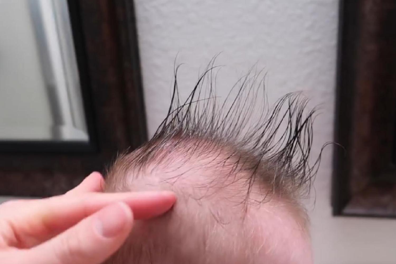 新生儿没剃胎发之前头发发黄,婴儿剃掉胎发后新长的头发有点黄