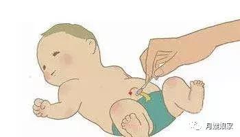 小孩长黄疸月嫂有责任吗,新生儿败血症和月嫂照顾有关