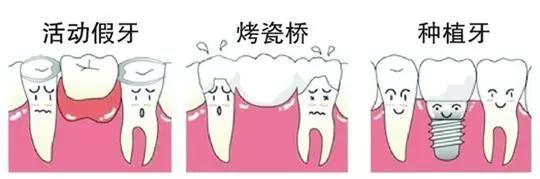 缺牙真的伤不起,缺牙对你最大的影响