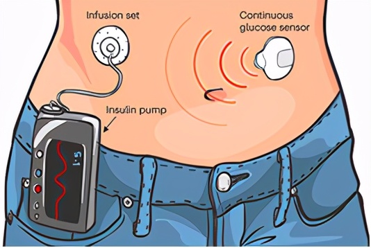 nature重磅揭秘人类抗击糖尿病历史,nature十大科学进展