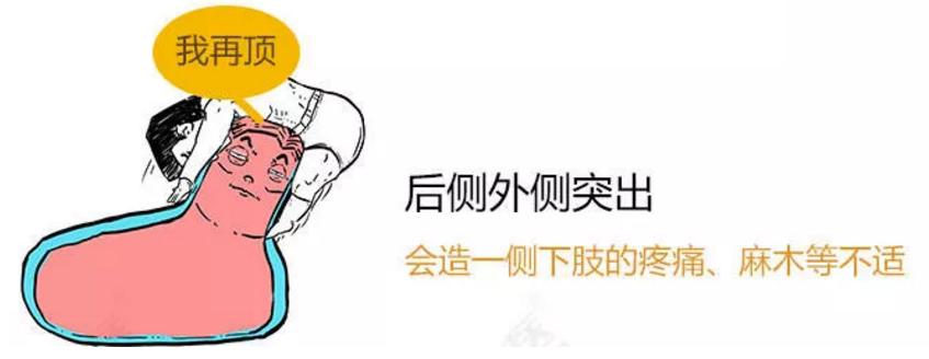 腰间盘突出别发愁记住3个技巧,专家告诉你腰间盘突出该怎么解决