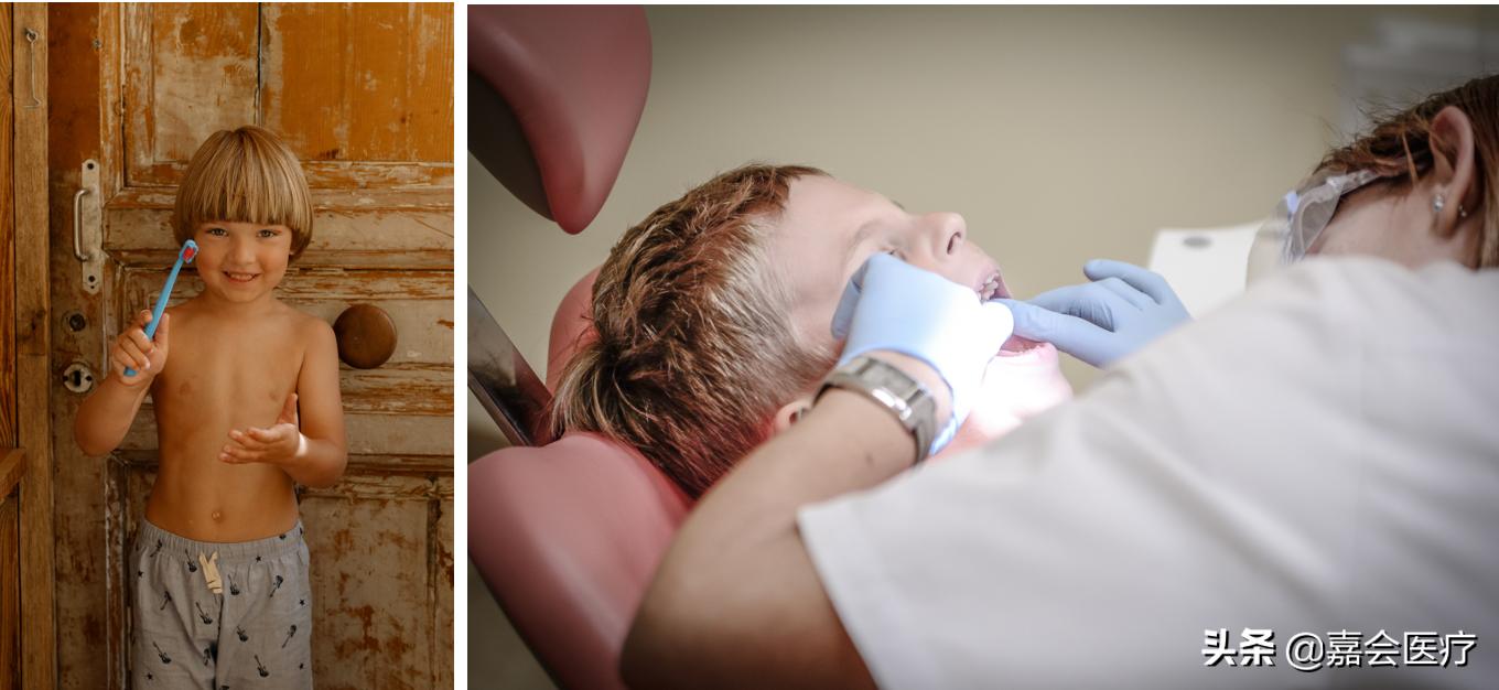 儿童龋齿产生的原因,儿童龋齿是什么意思