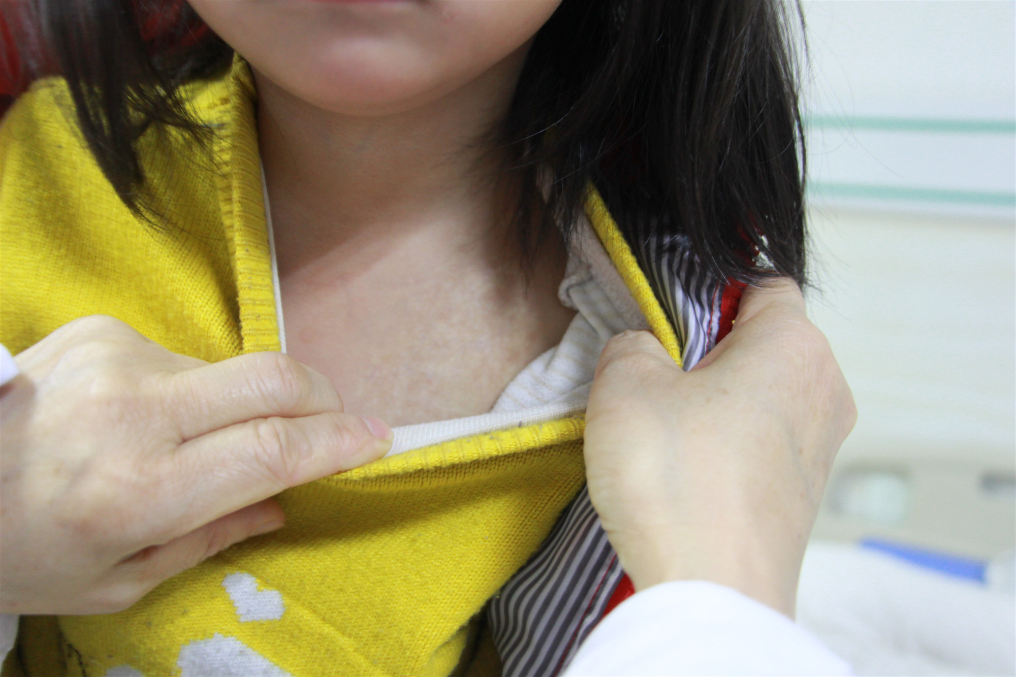 2岁女儿血管瘤,2岁小女孩肝血管瘤