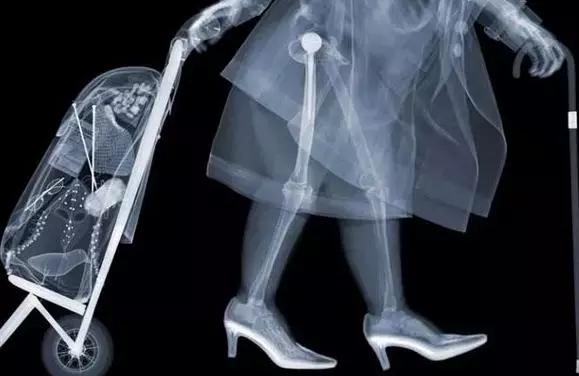 x光b超ct核磁共振区别,ctx光和b超核磁共振的区别