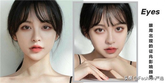 眼部脂肪粒能用眼霜祛除吗,去除眼部脂肪粒最佳方法