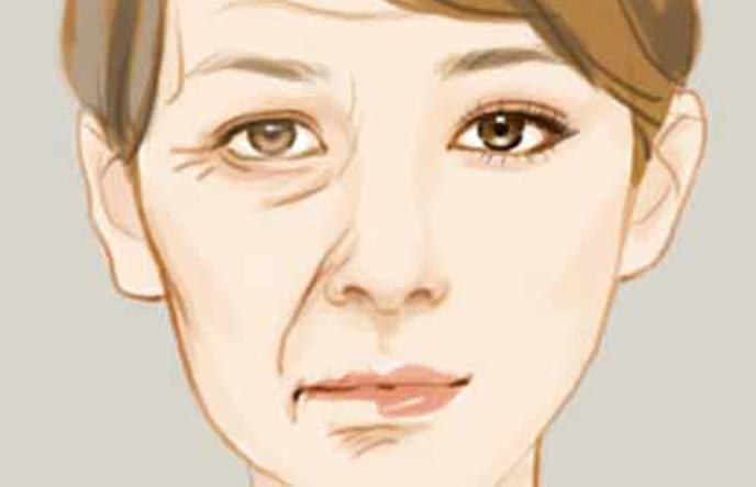 淡化法令纹真正有效果的方法,有什么方法淡化法令纹