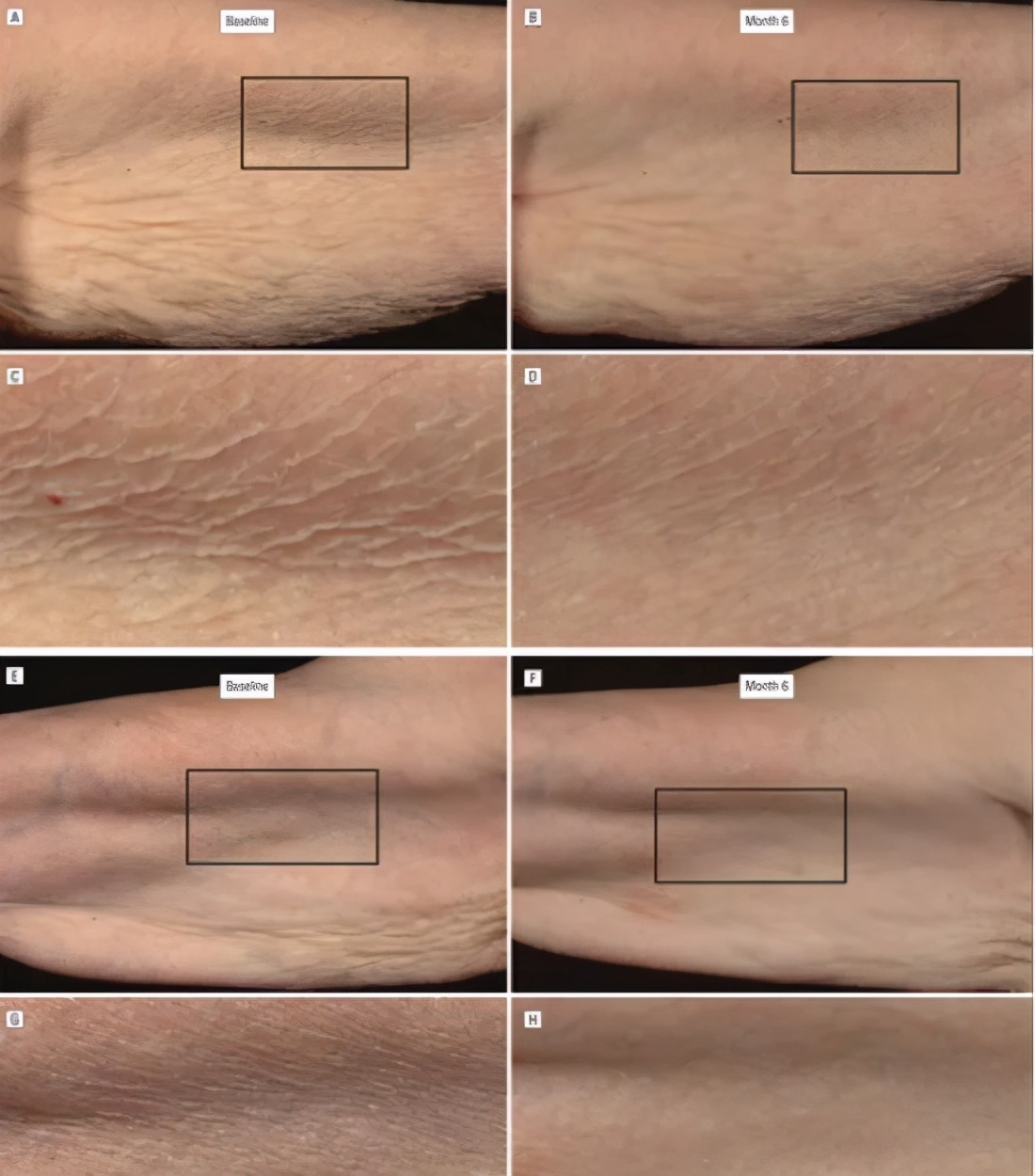 a醇到底好不好用,细说a醇